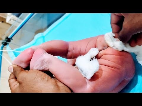 Formula Diaper Change in Newborn Boy👶🍼 | Complete NICU Feeding Observation & Safe Baby Care Tutorial
