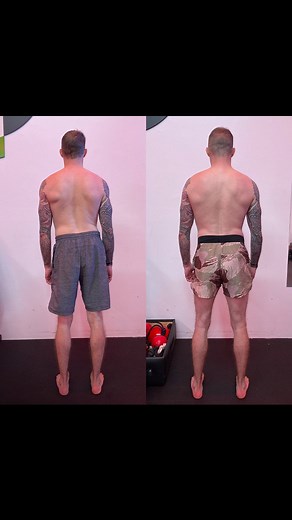 Functional Patterns on Instagram: "HIP SHIFT? Our daily lives will tend to push us to use one side of our bodies more than the other. This leads to asymmetries within our bodies. Whether it’s the sports you play or the jobs you do it’s important to think about how they may be affecting your body. Fixing asymmetries is not as simple as simple writing with your left hand or learning how to switch hit. A reprogramming of your myofascial system is needed. FP is here to help teach you how to promote 