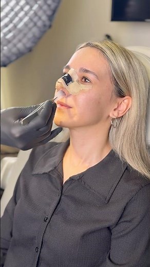 Nasal Pack Removal Made Easy 👃✨