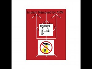 Adventures Of The Alien Resistance Movement