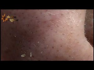 Continue to Relax with the Nippers