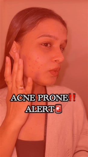 Yashaswi Soni | Skincare | Makeup on Instagram: "Comment “Gel” incase you need the link♥️ This is the worst my skin has ever looked. Painful acne. Pus. Red, inflamed, everywhere.😒 we all know how painful it feels 😔 but few weeks back I stayed consistent with this gel twice a day for three weeks, without skipping. And my skin started feeling calmer. My acne felt more under control, and my skin finally started healing. [acne, acne corrector, plix acne corrector, dark spot, pimples,