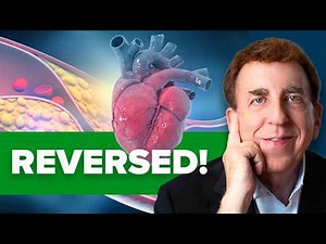 Dr. Dean Ornish: How He Proved Heart Disease Can Be Reversed
