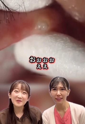 目の中の白い糸とは？医療と美容の真実