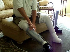 Patient's fitting HAWK C Braces