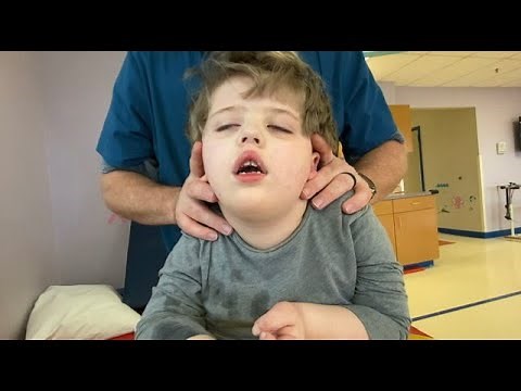 Unseen Seizure at Physical Therapy, Seizures Change, Special Needs Routine, Epilepsy, Many Seizures