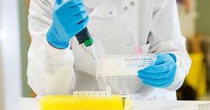 New urine test for prostate cancer ‘has enormous potential’