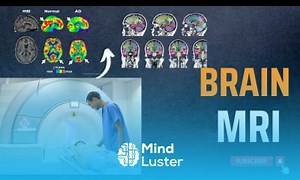 Mind Luster - Learn Brain MRI Positioning and Planning Brain MRI Working Principle