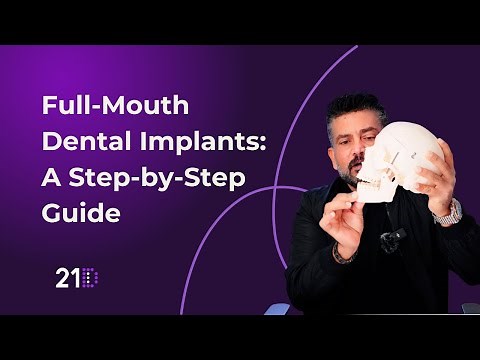 Full-Mouth Dental Implants: Step-by-Step Guide Procedure at 21D