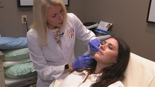 Subtle lip enhancements gain popularity over dramatic fillers
