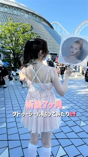 側弯症術後の傷跡経過🩹