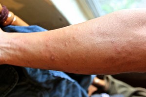 チンクイって？海の中の危険な生き物 [ボディボード] All About