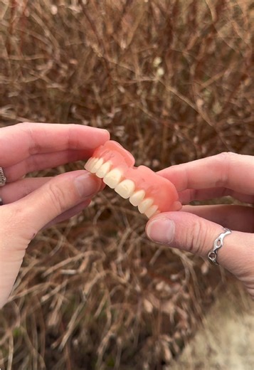 Fertigstellung Oberkiefer Totalprothese #dentaltech #dentist #dents #zahntechnik #dental