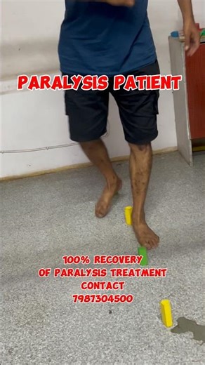 Recovery Of Paralysis Patient 💪