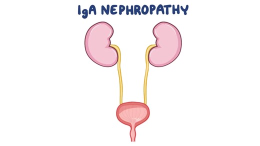 7分钟认识什么是IGA肾病