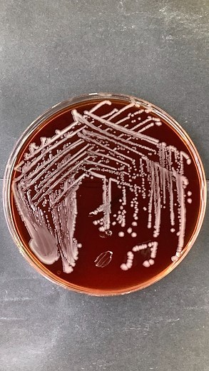 Good Ol' Gab on Instagram: "Homemade agar plate"