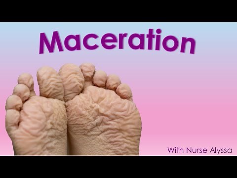 Understanding Wound Maceration