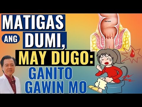 Matigas ang Dumi, May Dugo: Gawin Ito. By Doc Willie Ong
