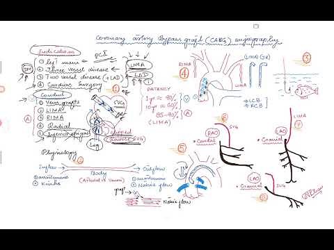 Coronary Angiogram for Bypass Graft (CABG)