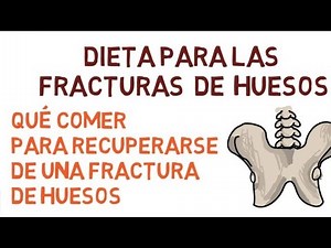 DIETA PARA RECUPERARSE DE UNA FRACTURA DE HUESOS