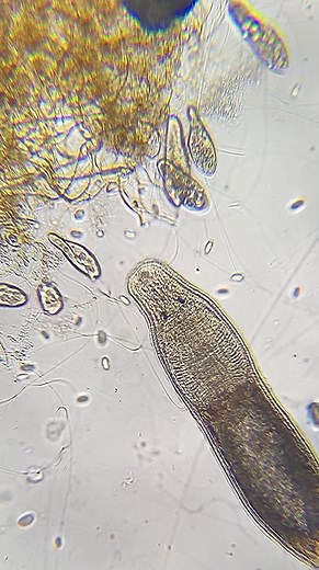 #kirby the gieysztoria #flatworm stuffs himself with #ciliates like a tiny #jabbathehutt