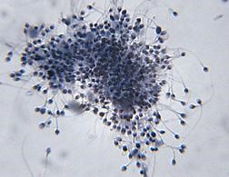 DNA testing makes it easy to find the identity of anonymous sperm donors.