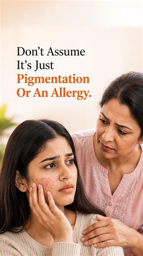 Dark Patches, Itching & Burning? It Could Be Lichen Planus
