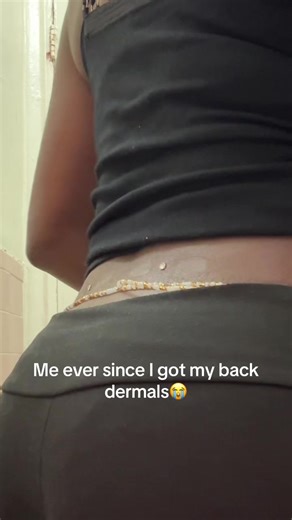 Back Dermal Piercing Healing Journey and Aftercare