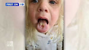 A four-year-old girl has suffered burns to her tongue after eating Warheads sour lollies. While there are clear warning labels on the packaging, dentists say they should be restricted for children because of high acidity levels. #9News | Nightly at 6pm | 9 News Melbourne