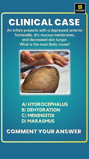 Utkarsh Nursing Classes on Instagram: "What’s the Cause of this Infant’s Condition? 👶 Comment the answer down below👇 . . . #utkarshnursing #utkarshclasses #disease #case"