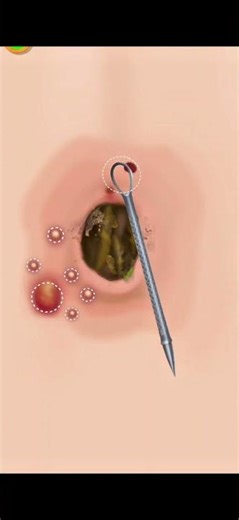 Extreme Dirty Belly Button Deep Cleaning Animation 4K ASMR