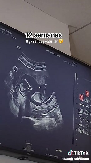 Detalles sobre la revelación del embarazo en 12 semanas