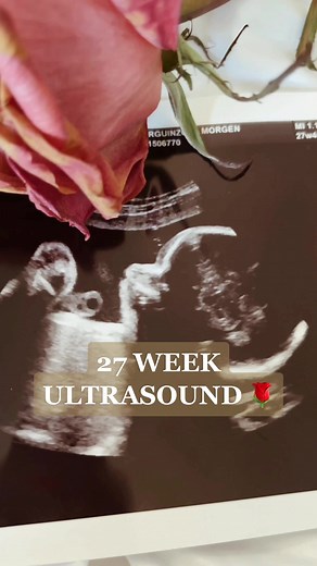 27 Week Ultrasound Experience | Baby's Anatomy Scan