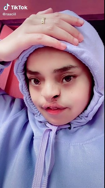 Understanding Hand Conditions: What Happened to My Hand?