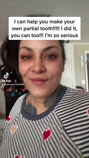 DIY Partial Denture Kit: Make Your Own Missing Tooth at Home!