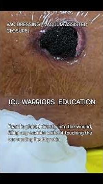 VAC DRESSING = VACUUM ASSISTEDCLOSURE #registered nurse #Advanced woundcare#criticalcare #medico