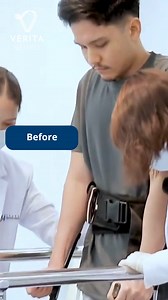 1.1K views · 42 reactions | Thoriq, T12 spinal cord injury patient, had LamiSpine treatment with us in 2019. The treatment begins with a Laminectomy, which then allows a highly directive and optimzed injection of stem cells, to heal damaged tissues. He has remained in Thailand, working with our specialist team and his condition is a remarkable example of what can be done with this treatment. | Epidural Stimulation Now | Facebook