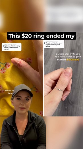 Unleash Your Creativity with Our Fidget Beads Ring! Feeling restless or looking for a way to stay focused? Our Fidget Beads Ring is here to help! 🎉 This stylish and versatile ring is not just a fashion statement; it's a soothing stress-relief tool! ✨ Twist, turn, and fidget your way to calmness anytime, anywhere! Perfect for meetings, studying, or just unwinding after a long day. 💖 Express yourself while keeping your hands busy! Get yours today and discover the fun of fidgeting in style! 👉 Cl