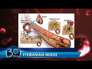 30' Υγεια - 04-05-16 (Στεφανιαια Νοσος - Bypass)