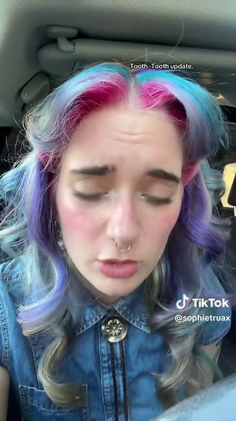 Tooth update | teeth