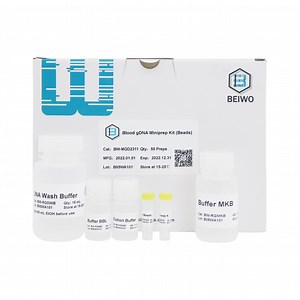 [Hot Item] Ivd Chemical Reagent Blood Gdna Isolation Kit Genomic DNA Extraction Kit