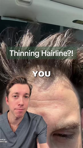 The Moment You Notice Thinning… That’s Your Sign. If you’re starting to notice more scalp showing, a widening part, thinning at the temples, or less density in photos this is the time to address hair loss. Not later. Hair loss is progressive. The earlier you intervene, the more hair you can preserve. Waiting often means more miniaturization and fewer options. Early treatment may include DHT blockers like finasteride or dutasteride, growth stimulators like minoxidil, and supportive therapies such