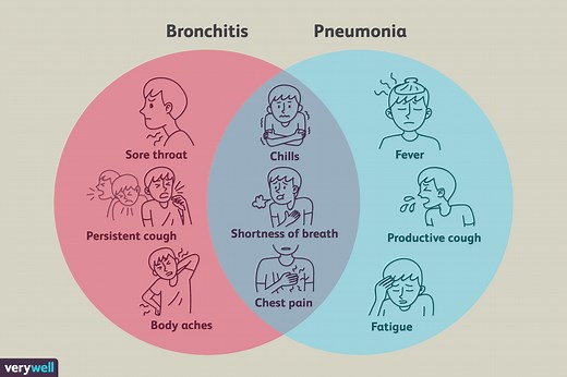 Bronchitis vs. Pneumonia: How to Spot the Key Differences