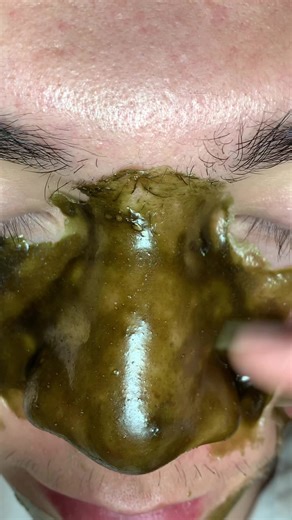 Essential Skincare Tips for Glowing Skin