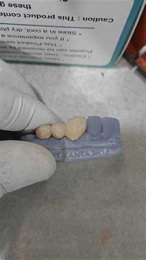 CAD/CAM dental crowns (Computer-Aided#dental #cadcam #deveshdental