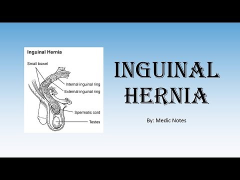 Inguinal hernia - direct vs indirect, anatomy of inguinal canal, deep ring occlusion test, surgery