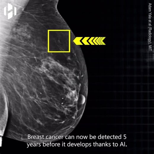 #ai #healthcare #technology #healthtech #innovation #robotics #medtech #healthylife | Luan P. | 15 comments