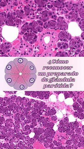 Diagnóstico Histológico de la Glándula Parótida