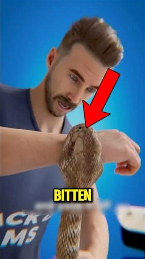 Bitten by a Venomous Snake? Here’s What Happens Next 😱