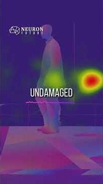 Neuroplasticity | #NeuralPlasticity #Neuroscience #BrainScience